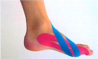 Medical Taping voor hallux